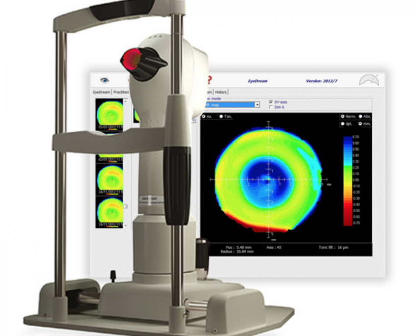 Myopia (Short-Sightedness) Control – Radlett Opticians